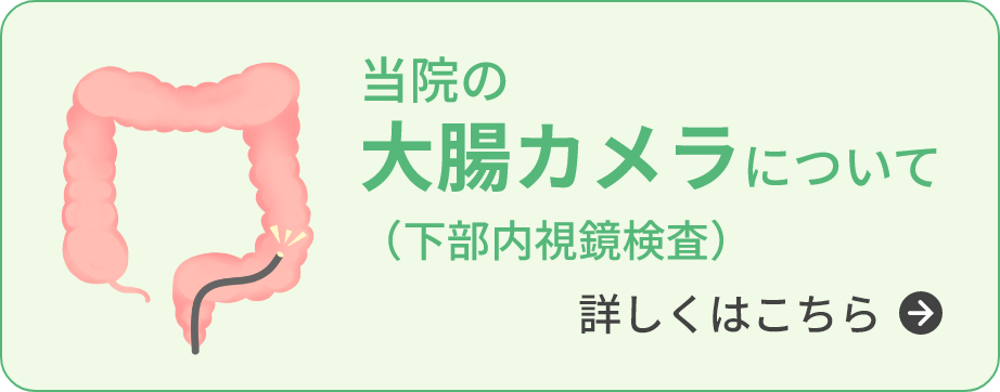 当院の大腸カメラ（下部内視鏡検査）について
